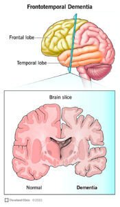 picture of brain