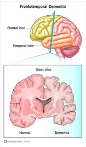 picture of brain