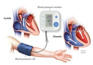 Blood pressure visual