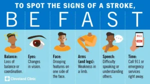 Be fast stroke acronym